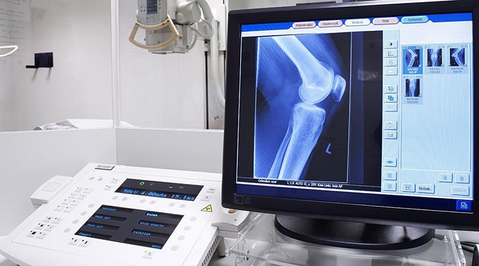 Análisis y Procesamiento de imágenes radiológicas 